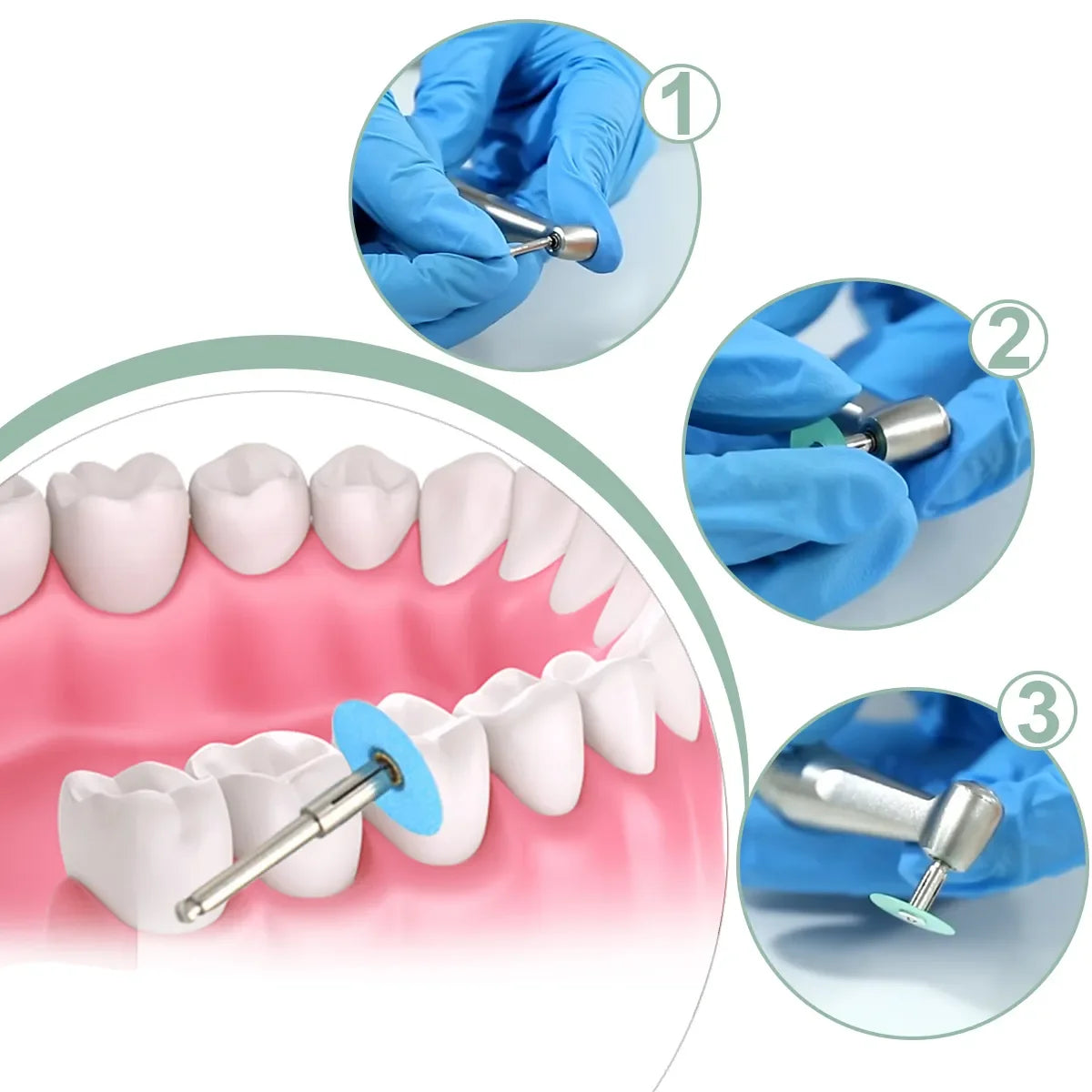 Ultra-Thin Dental Polishing Discs for Composite & Ceramic Restorations